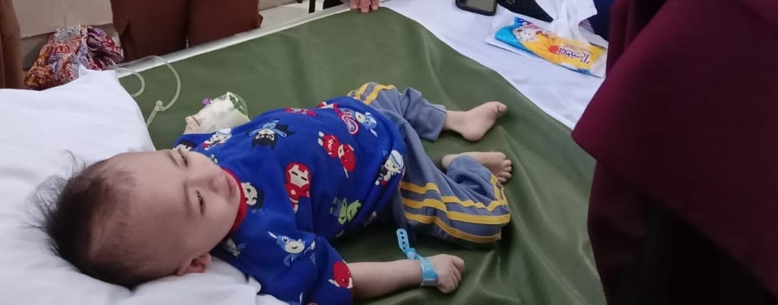 Balita Gizi Buruk di Sukabumi Diduga Brain Death Jadi Sorotan